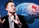 Người thứ ba cấy chip não của tỷ phú Elon Musk