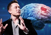 Người thứ ba cấy chip não của tỷ phú Elon Musk